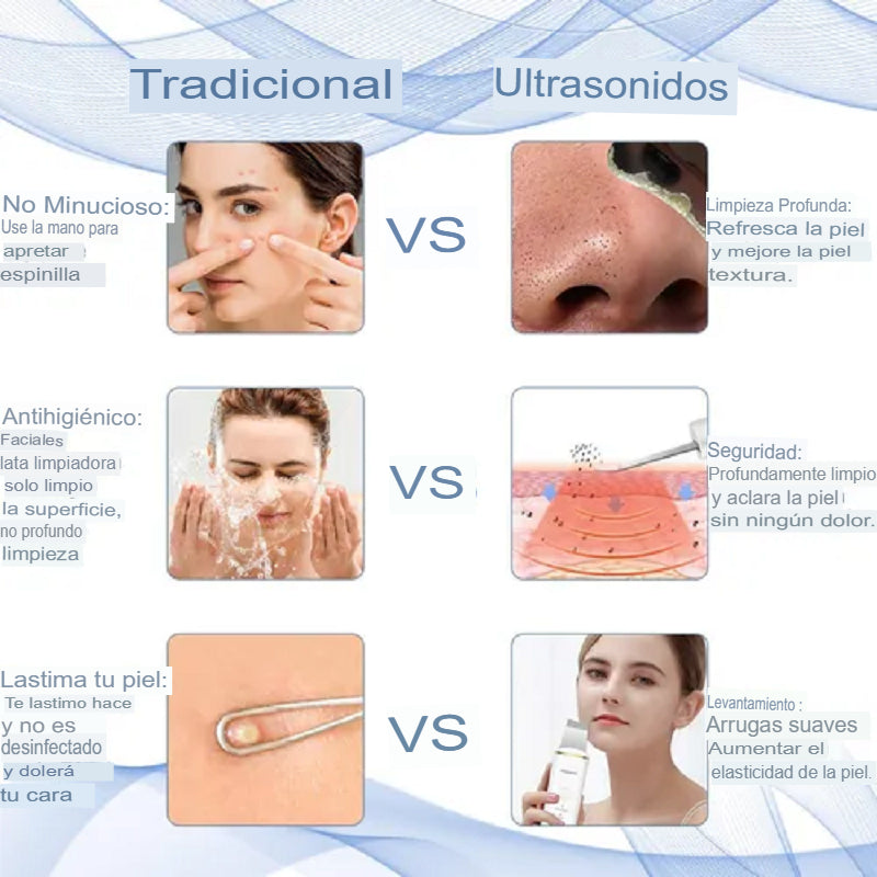 Peeling Limpiador de Poros con Vibración