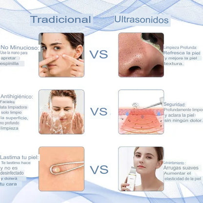 Peeling Limpiador de Poros con Vibración