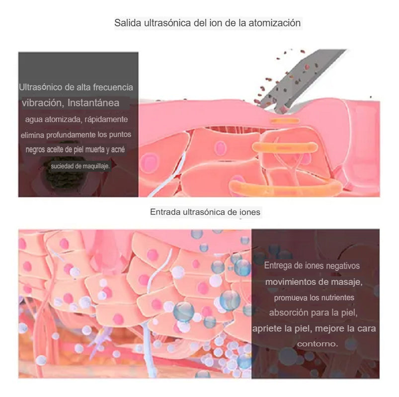 Peeling Limpiador de Poros con Vibración