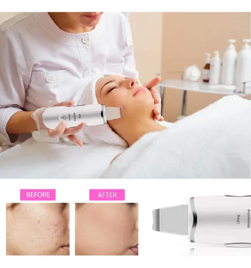 Peeling Limpiador de Poros con Vibración