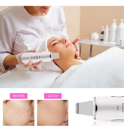 Peeling Limpiador de Poros con Vibración
