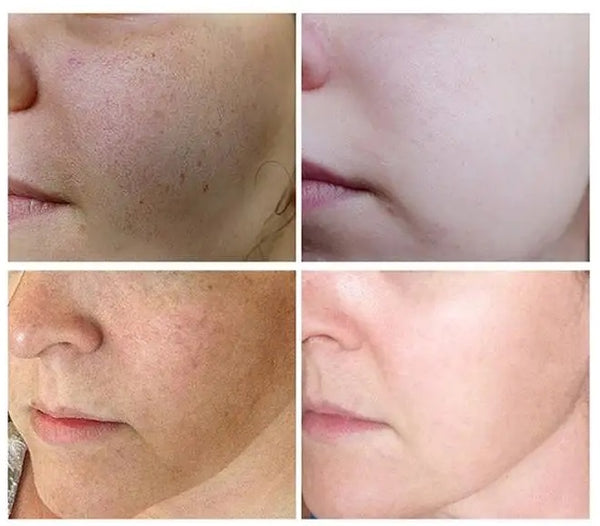 Kit de Belleza Bioaqua X 5 Unidades