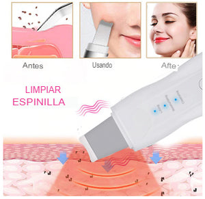 Peeling Limpiador de Poros con Vibración