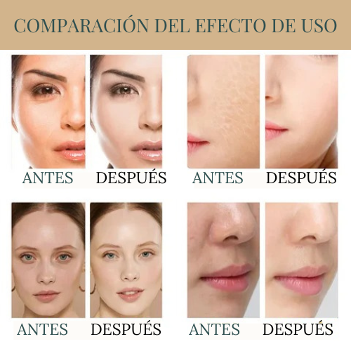 Serum de Arroz Bioaqua