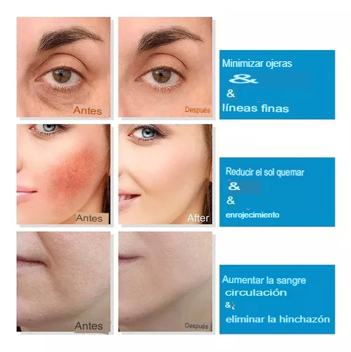 Masajeador Facial Bolas de Hielo