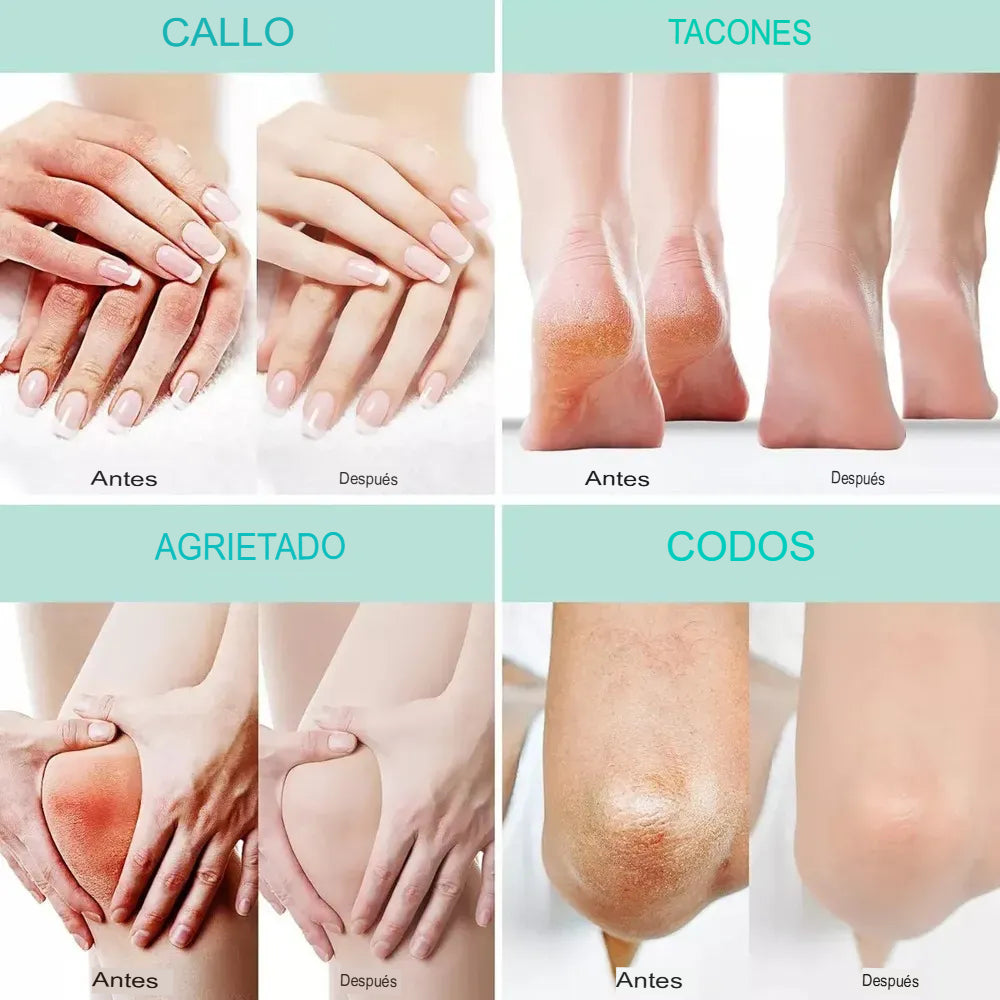 Suavidad que se siente - Crema Urea al 40%